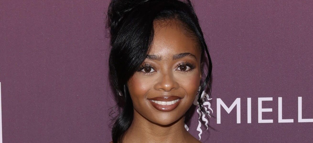 Skai Jackson Talks Struggle With Postpartum Hair Loss