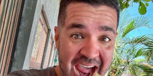 Food Influencer Nathan Aguilera Faces Skull Surgery After Accident